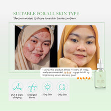 Load image into Gallery viewer, Bye Bye Acne Glossy Serum